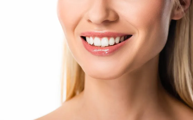 Are Veneers Permanent?