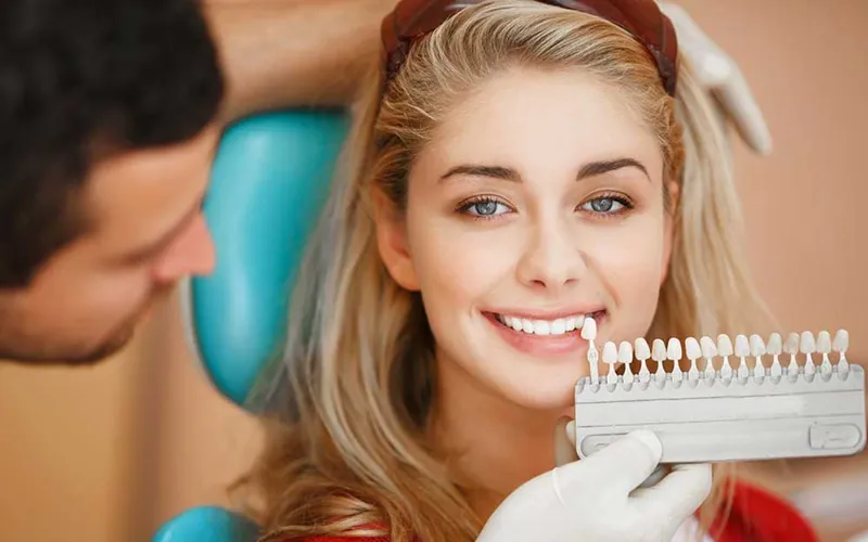 How Long Do Veneers Last On The Teeth?