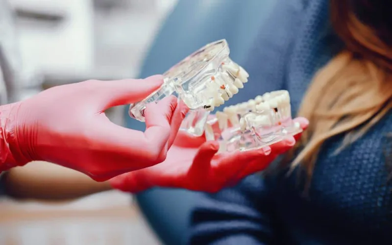 All-On-4 Implant Supported Restoration