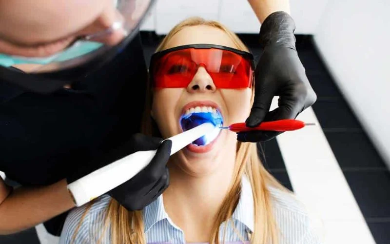 The Benefits of Modern Tooth-Colored Fillings