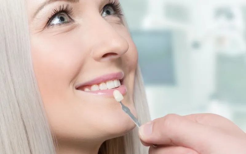 Is Veneer Good For The Teeth?